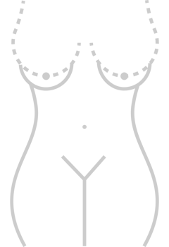 Breast Cancer Surgery vector