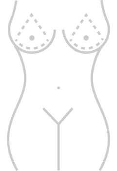 Breast Cancer Surgery vector