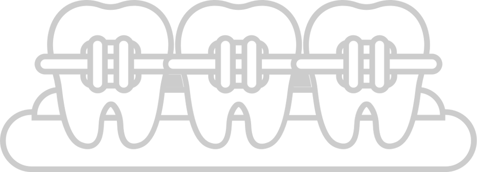 Braces vector