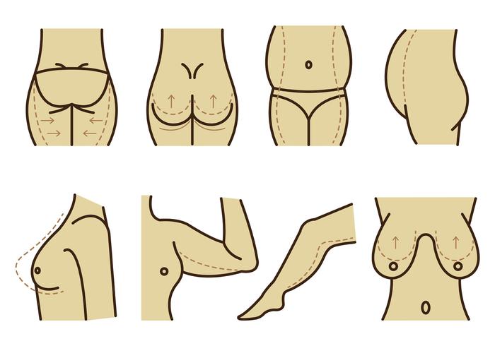 Set Of Plastic Surgery Vector Set Of Plastic Surgery Vector