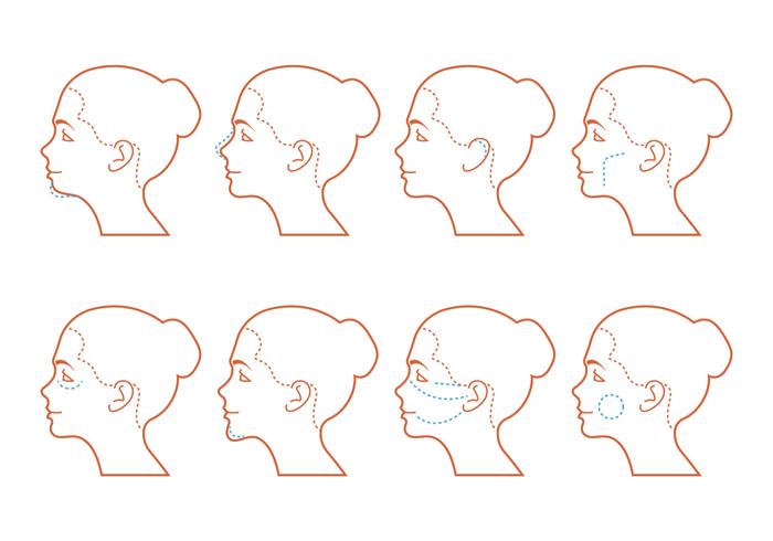 Face Surgery vector