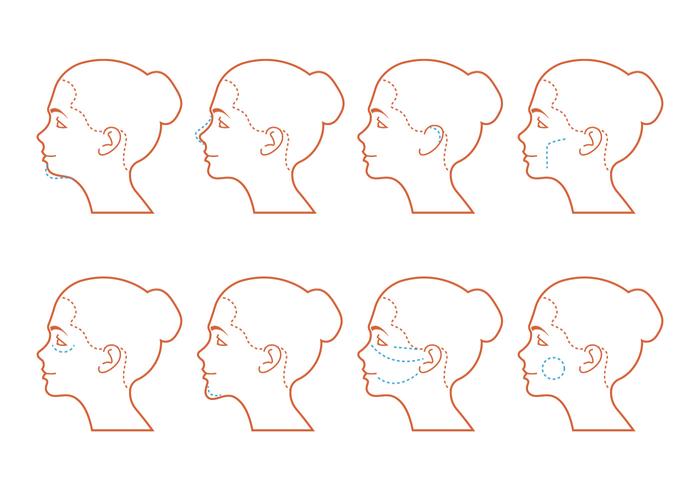 Face Surgery vector