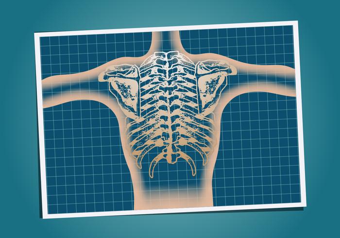 Vector monitor de la caja torácica