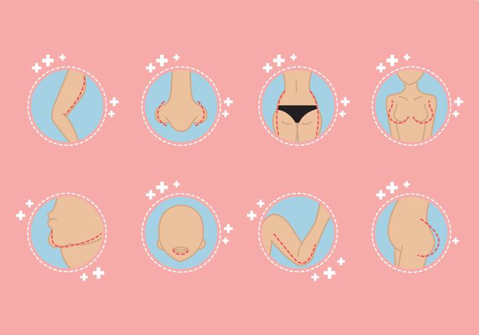 Free Girl Plastic Surgery Free Girl Plastic Surgery