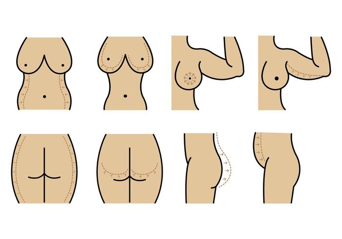Set Of Plastic Surgery Vector