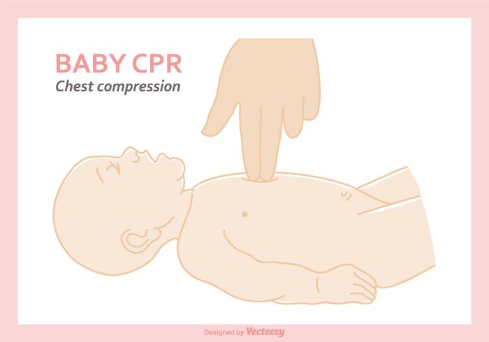 Free Baby CPR Vector Illustration