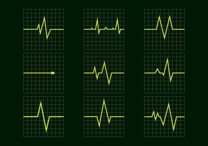 Flatline Icono Vector Libre