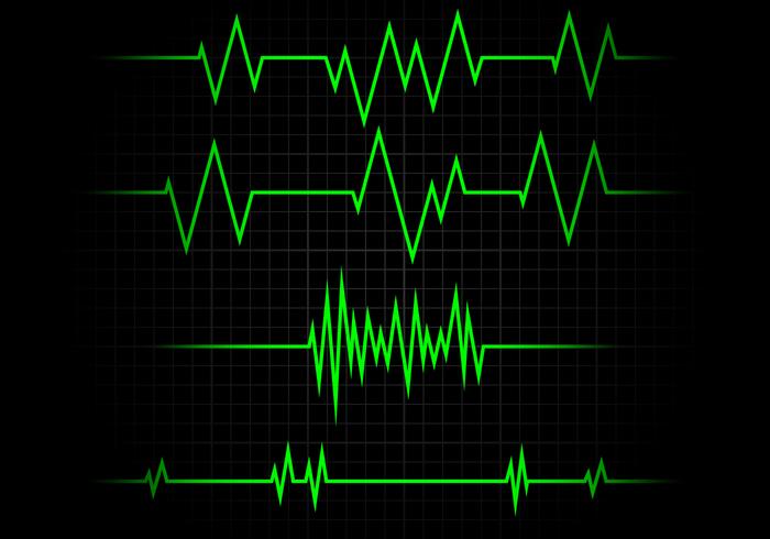 Flatline Free Vector