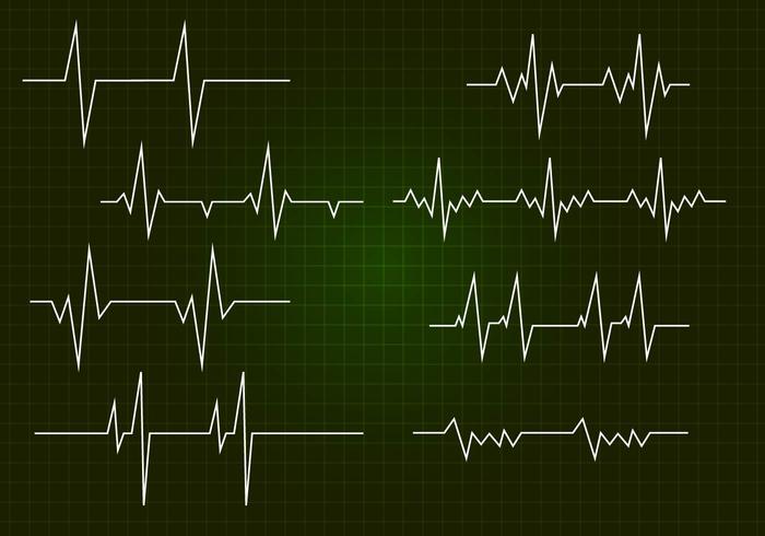 Free Flatline Vector