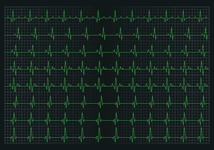 Gráfico de pulso cardiaco vector