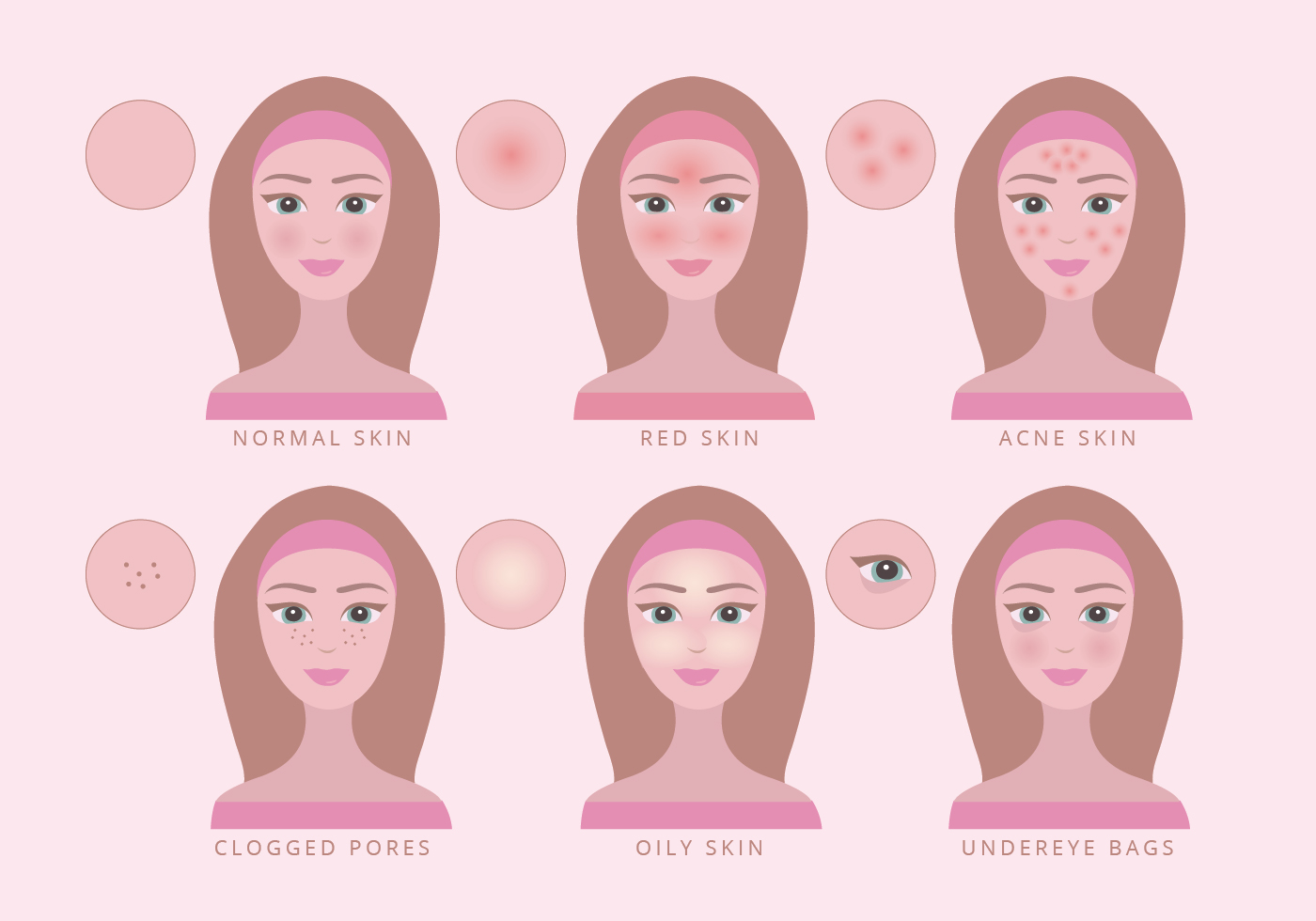 Vector Skin Conditions Illustration 155709 Vector Art at Vecteezy