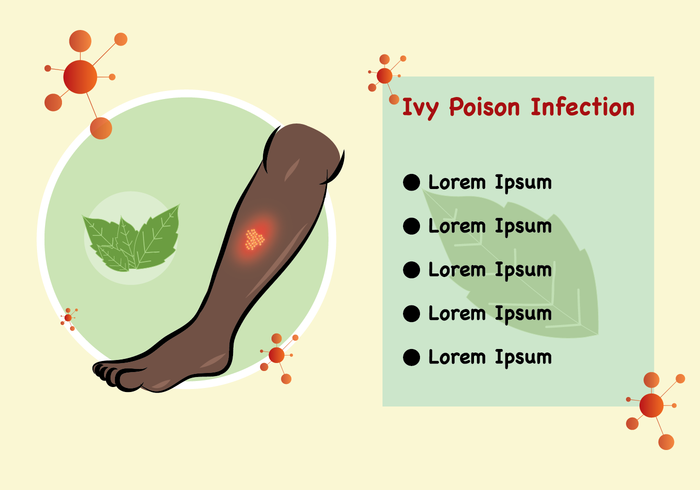 Infección por veneno de hiedra vector