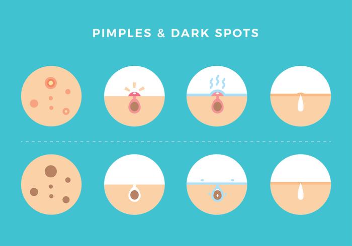 Pimples And Dark Spots Free Vector