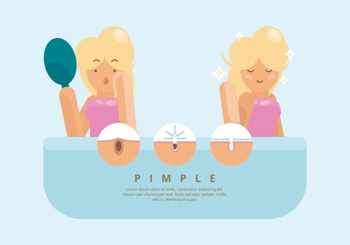 Pimple Illustration vector