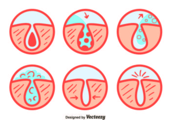 Pimple Vector Set