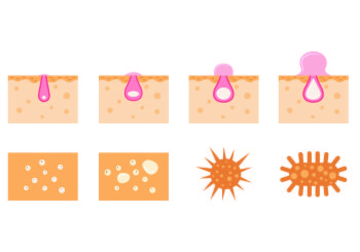 Set Of Pimple Icons vector