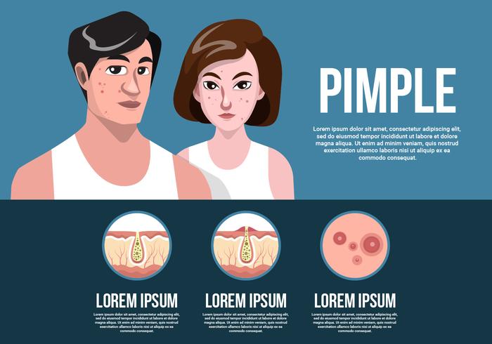 Mujer y hombre con espinillas en la cara Ilustración vectorial vector