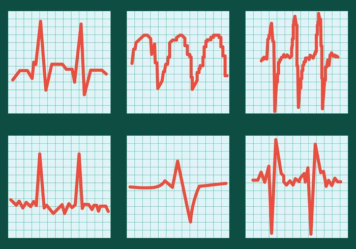 Iconos del vector del ritmo cardíaco