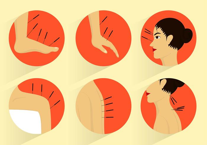 Acupunctur Set Free Vector