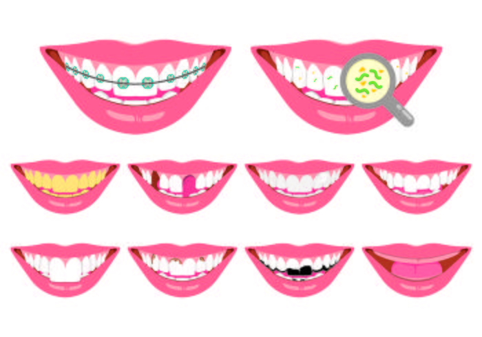 Conjunto de icono de dientes falsos vector