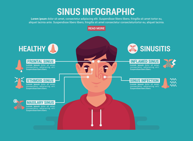 infografía sinusal vector