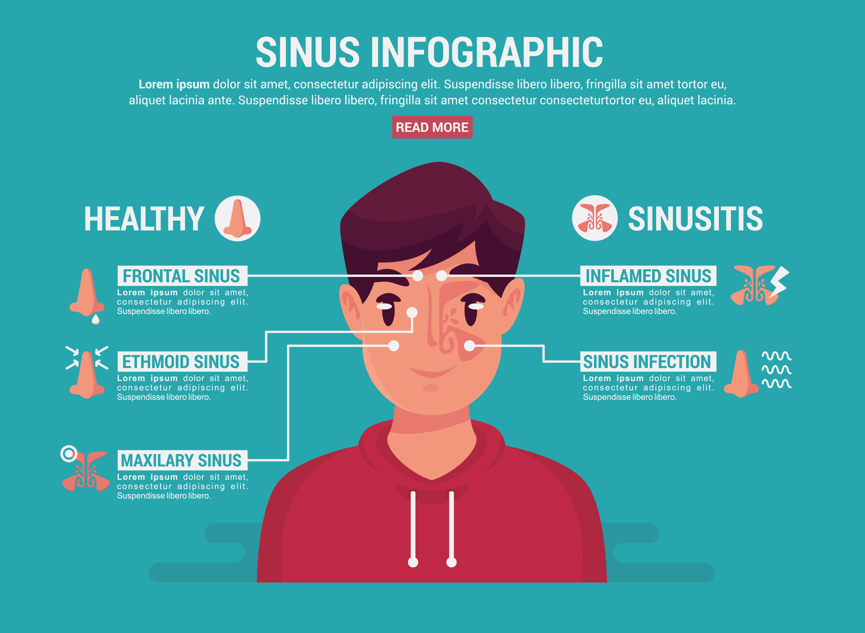 Sinus Infographic - Download Free Vectors, Clipart Graphics & Vector Art