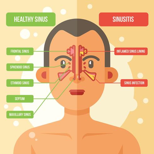 Sinus Vector Illustration