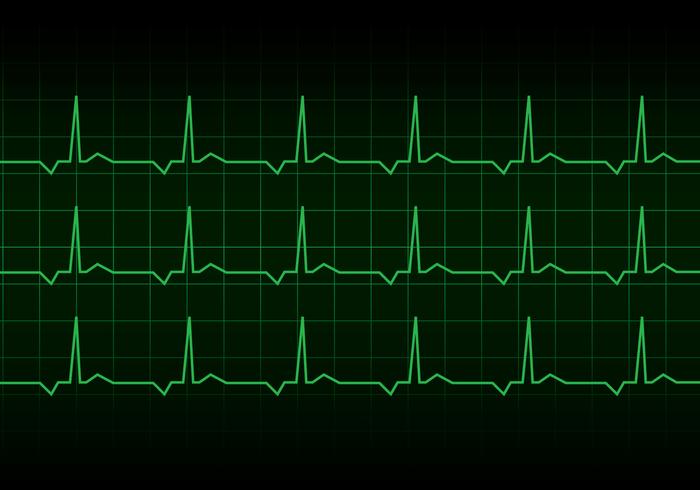 Heartbeat Heart Rhythm Monitor Vector 