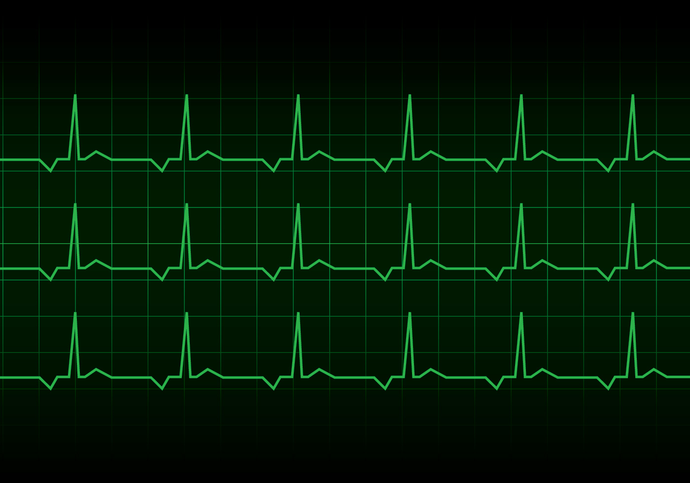 Download Heartbeat Heart Rhythm Monitor Vector 180614 Vector Art at ...