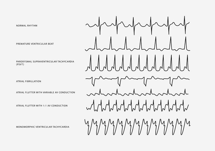 Free Free Heart Rhythm Svg 854 SVG PNG EPS DXF File