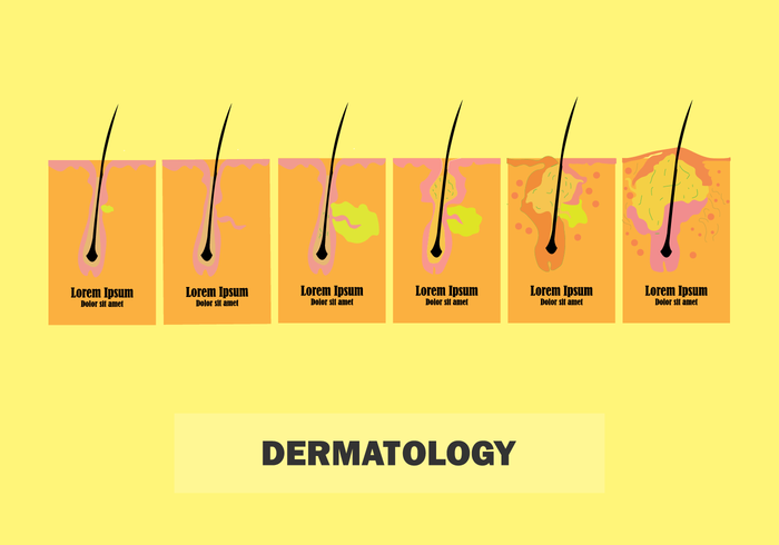 Dermatología de la piel para cualquier propósito vector