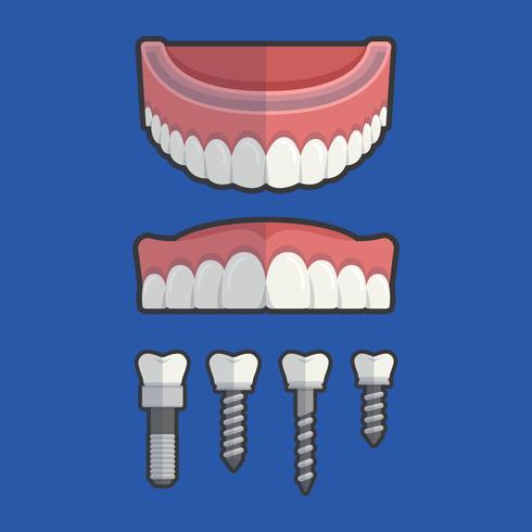 Dientes falsos con la ilustración del vector de tornillo