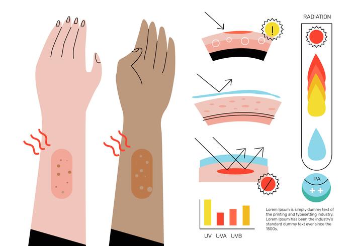 elementos de infografía ultravioleta vector ilustración plana