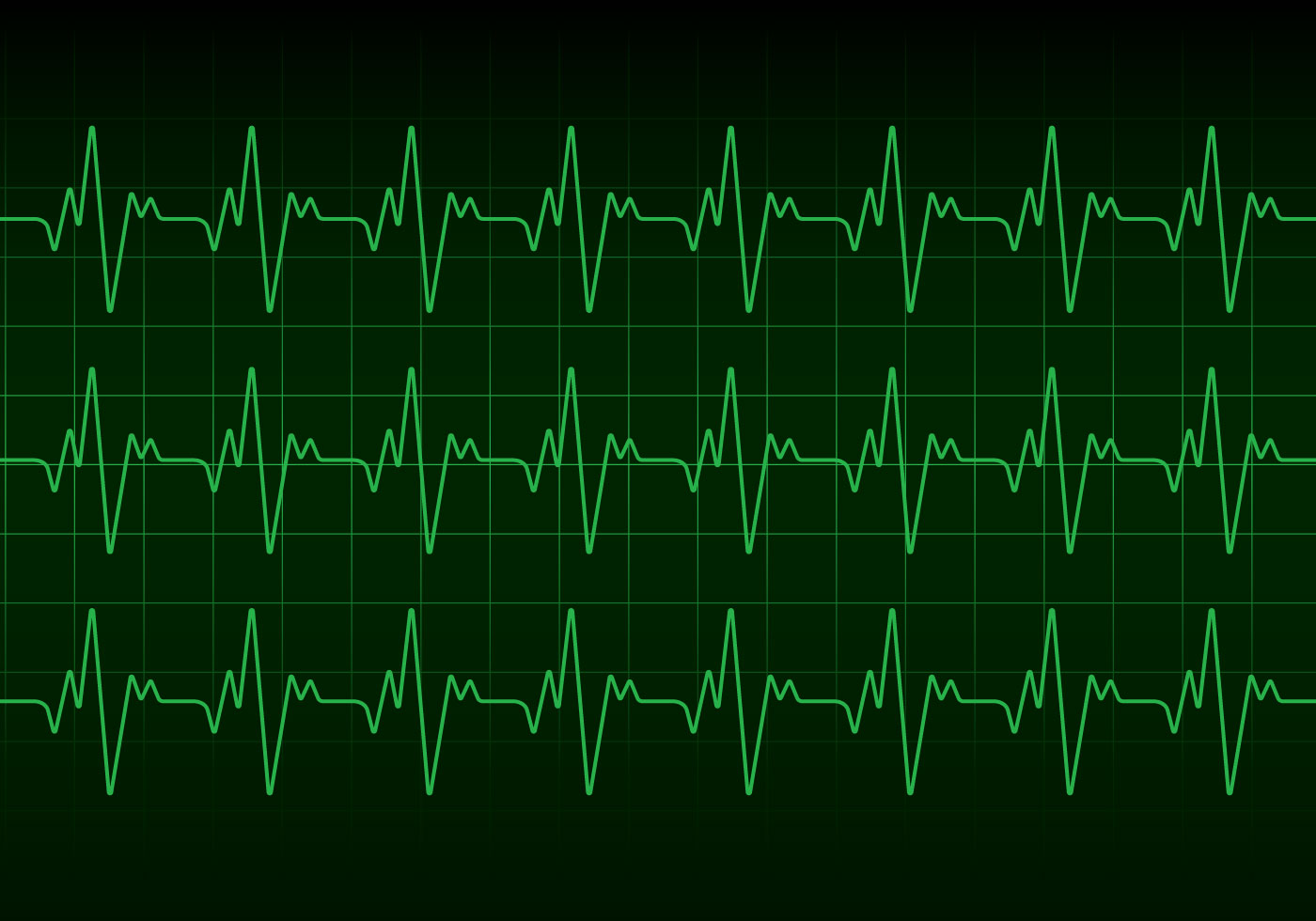 Heartbeat Monitor Vector 237799 Vector Art at Vecteezy
