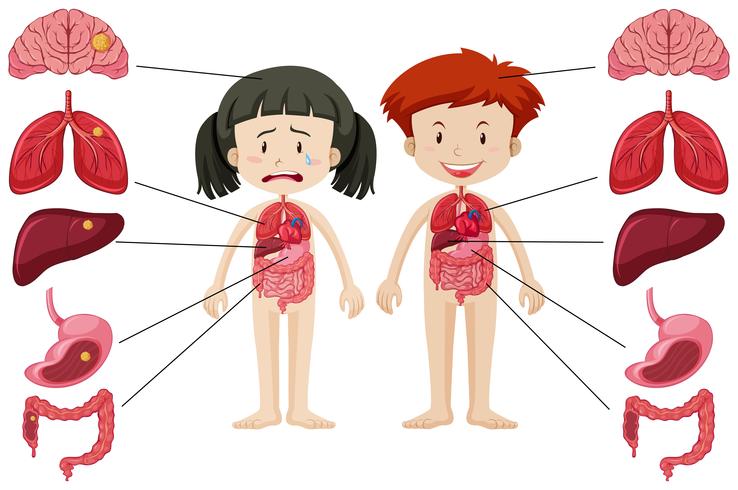 Girl and boy with different healthy and unhealthy body vector