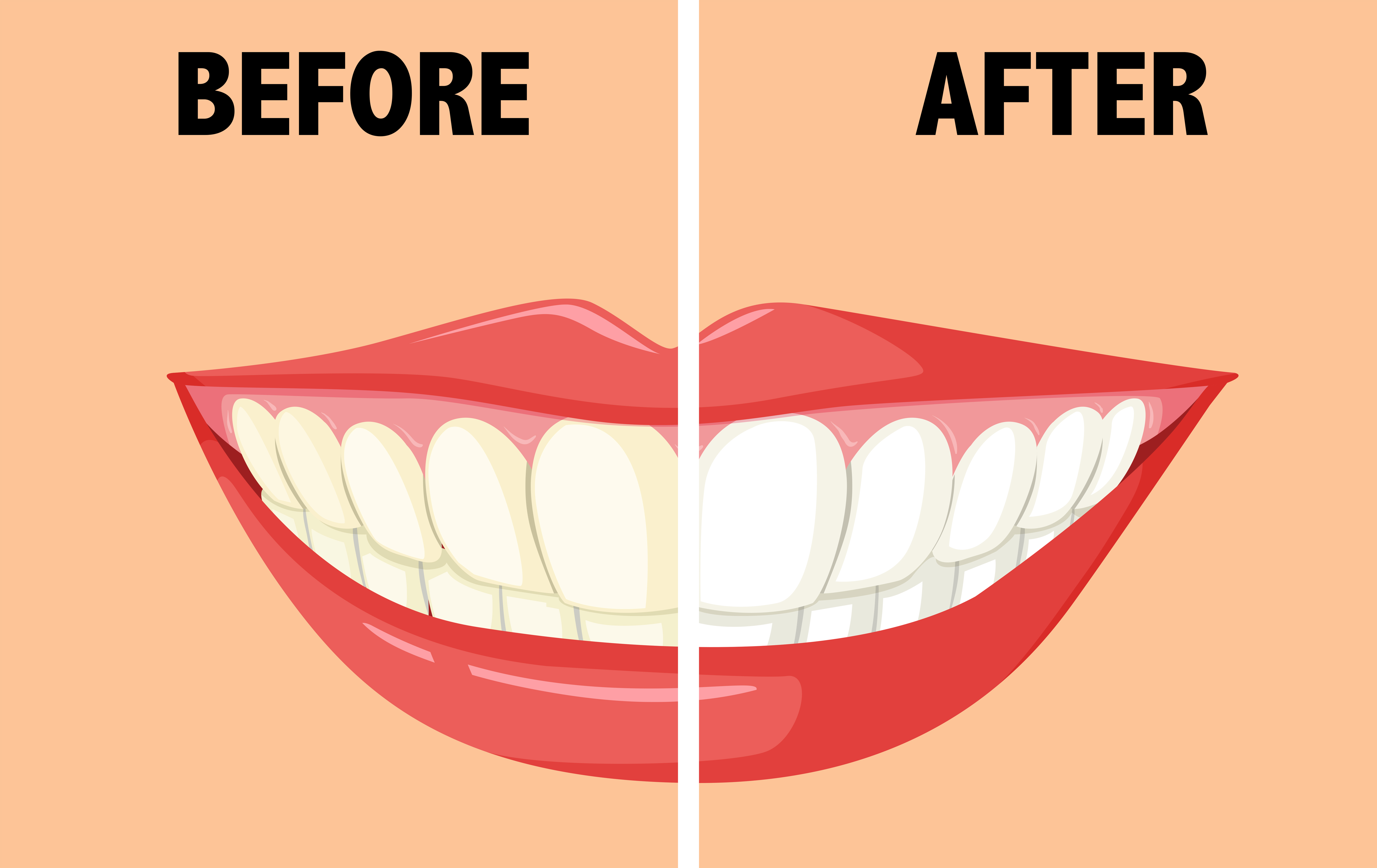 Before and after brushing teeth 293918 Vector Art at Vecteezy