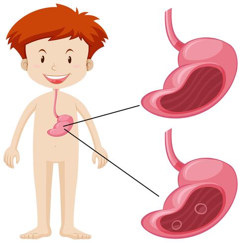 Little boy and unhealthy stomach vector