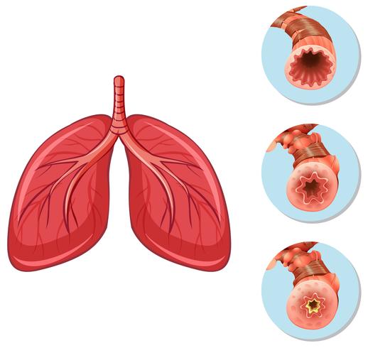 Etapas de la vía aérea del bloque a los pulmones. vector