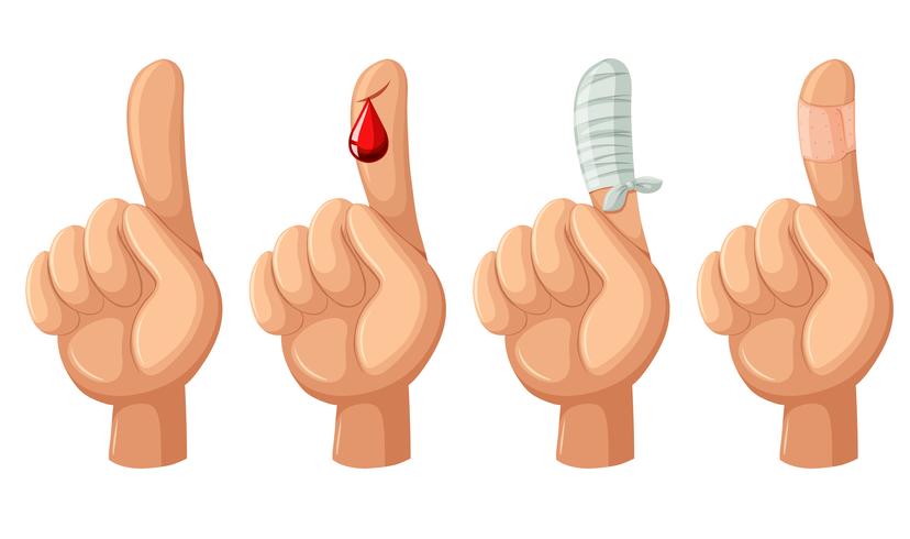 Finger with cut and bandages vector