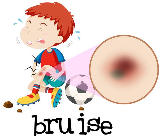 A Young Boy Habing Bruise vector