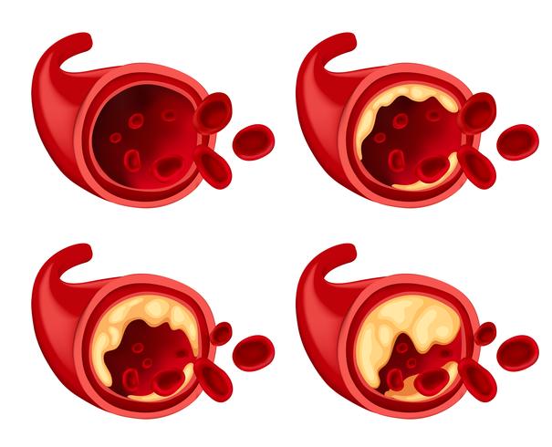 Diagrama que muestra la grasa en la sangre. vector