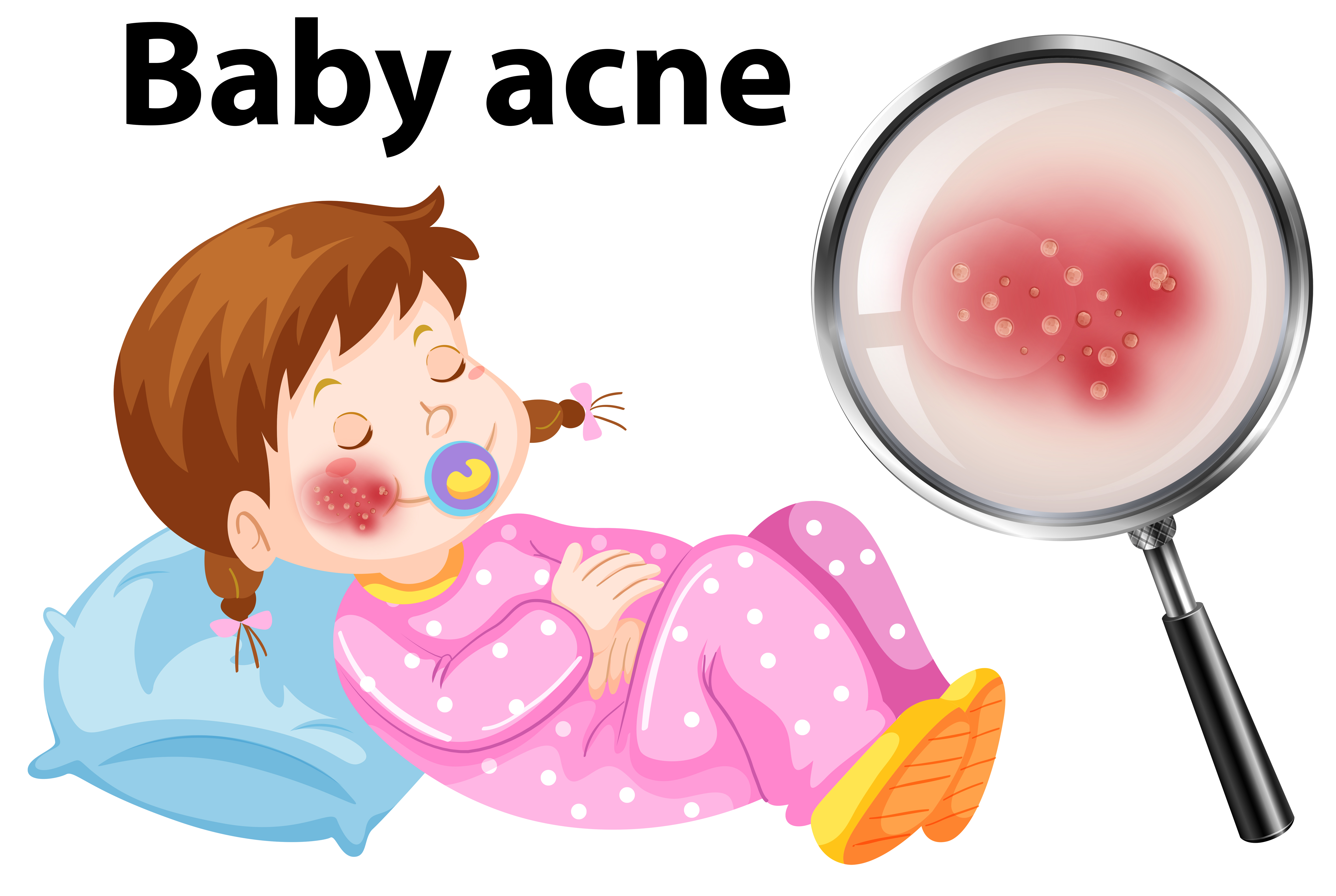 Download A Baby Acne on Face - Download Free Vectors, Clipart ...