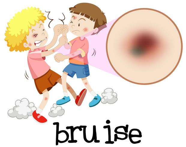 Young boys fighting with magnified bruise vector