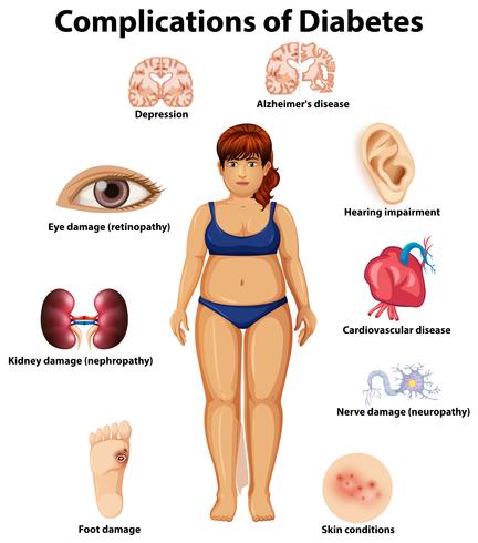 Complicaciones de la diabetes vector