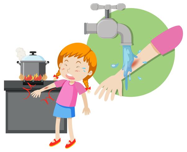 A girl first aid burn vector