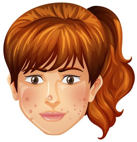 A Girl with Pimples Problem vector