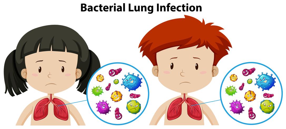 A Set of Bacterial Lung Infection vector