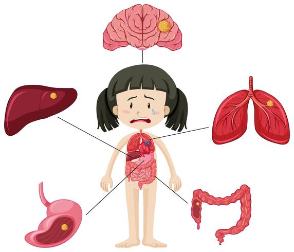 Diagrama de niña triste y niño insalubre vector