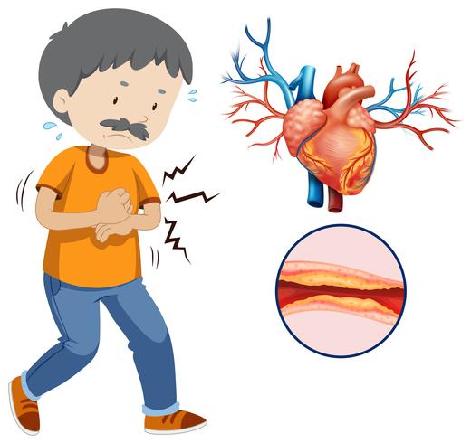 Un problema del corazón humano en el fondo blanco vector