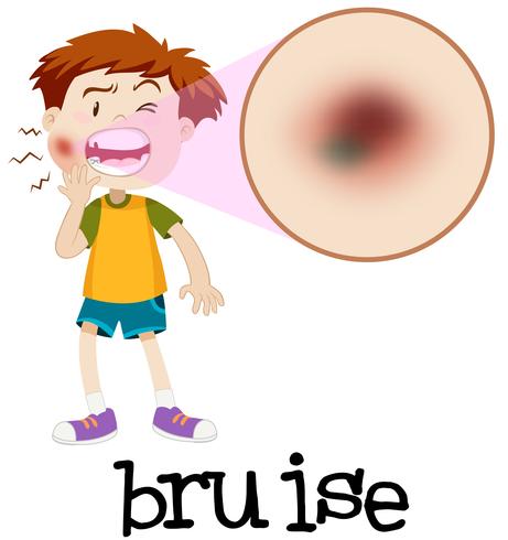 Magnified boy with bruise vector